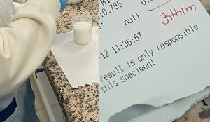 Si kryhet testi i aflatoksin&euml;s!