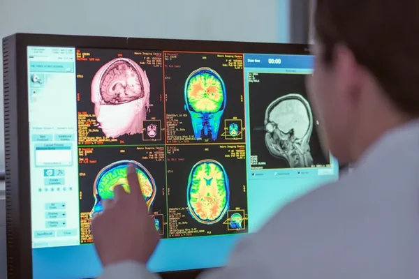 Nga adoleshenca tek demenca: Pesë fazat që formojnë trurin