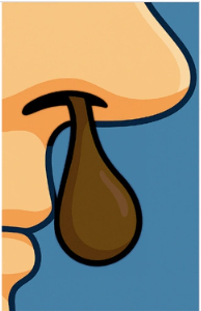 Çfarë fshihet pas ngjyrës së sekrecioneve të