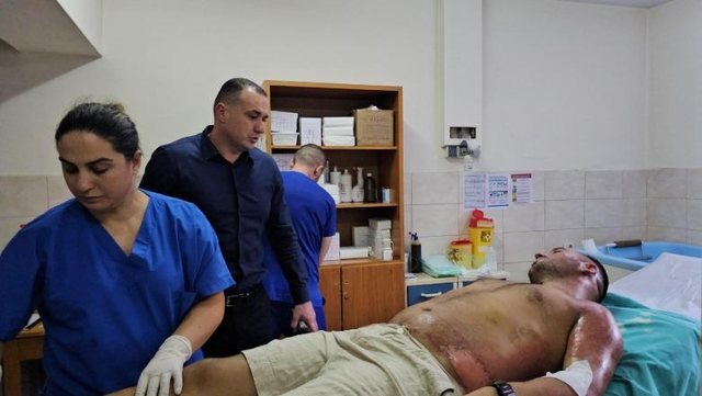 U dogj nga flakët gjatë aksionit për shuarjen e zjarrit. Ja si
