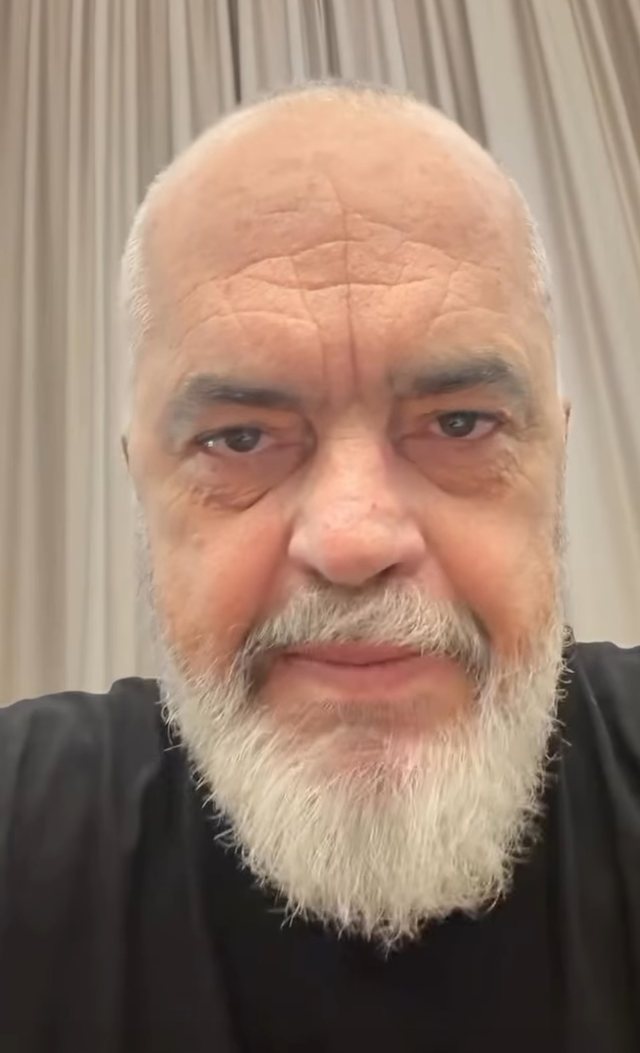 Kryeministri Rama: Gratë që heqin gjirin, do e ribëjnë pa