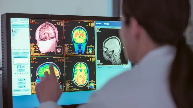 Nga adoleshenca tek dementia: Pesë fazat që formojnë trurin