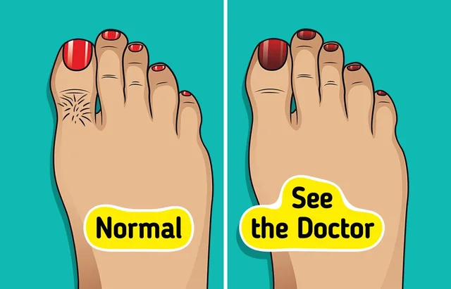 Çfarë ju tregojnë këmbët për shëndetin? 9