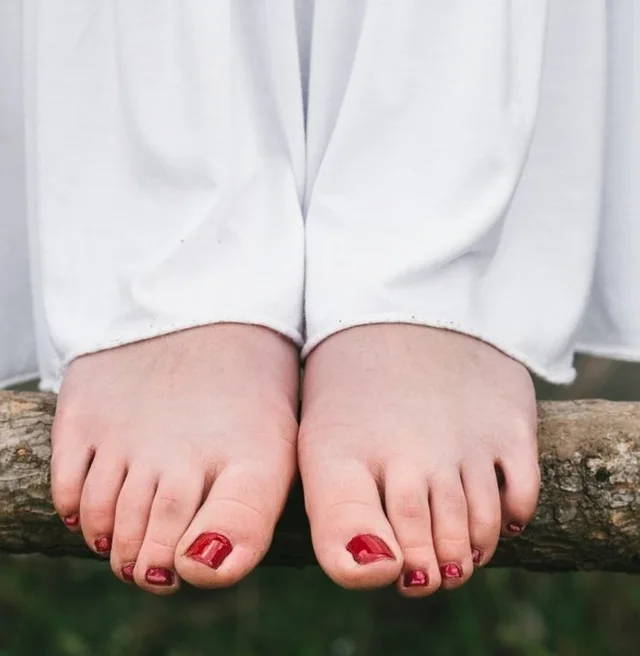 Çfarë ju tregojnë këmbët për shëndetin? 9