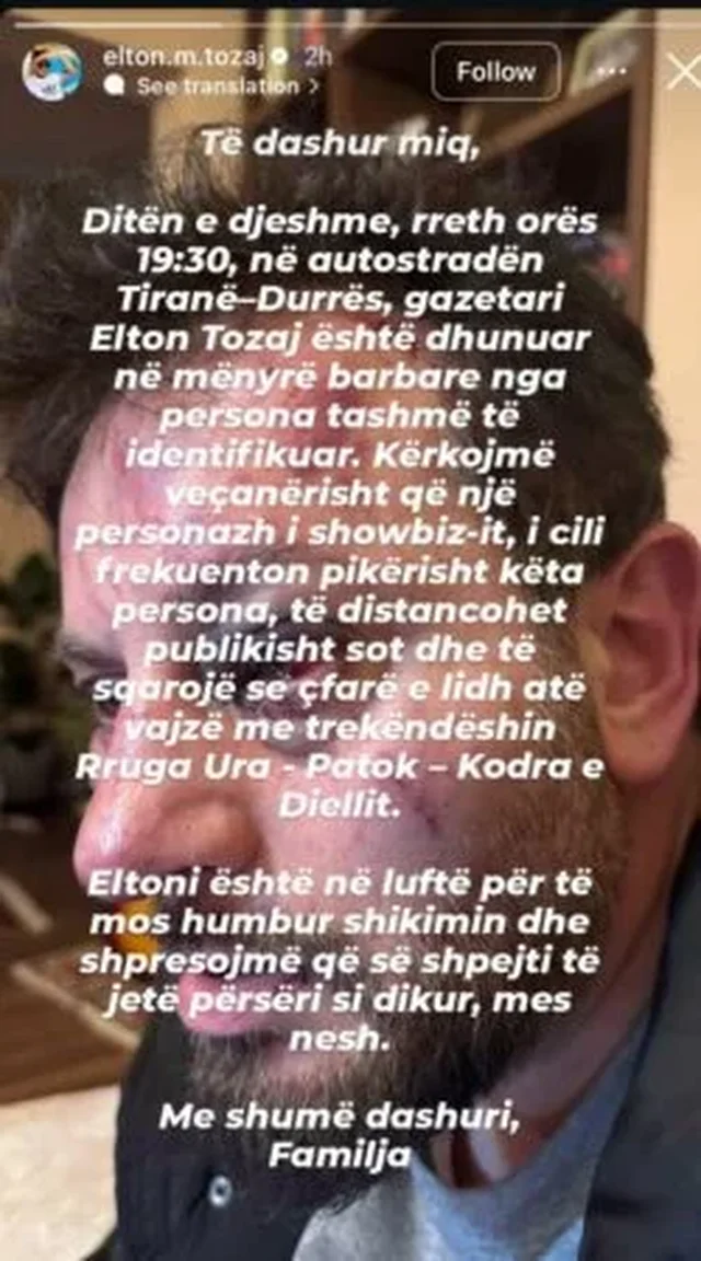 Dhunohet gazetari Elton Tozaj