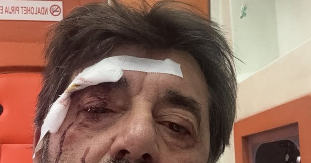 Dhunohet barbarisht gazetari Ilir Demaliaj 