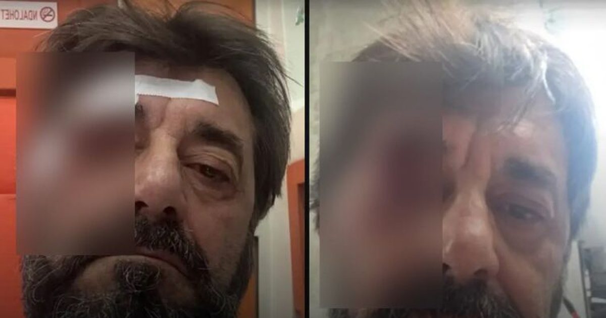 arrestohet-nje-nga-autoret-qe-dhunoi-ilir-demalian