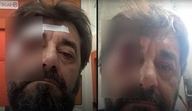 &nbsp;Arrestohet nj&euml; nga autor&euml;t q&euml; dhunoi Ilir Demalian