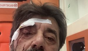 Dhunohet barbarisht gazetari Ilir Demaliaj!