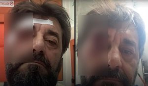 &nbsp;Arrestohet nj&euml; nga autor&euml;t q&euml; dhunoi Ilir Demalian
