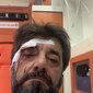Dhunohet barbarisht gazetari Ilir Demaliaj!