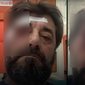 &nbsp;Arrestohet nj&euml; nga autor&euml;t q&euml; dhunoi Ilir Demalian