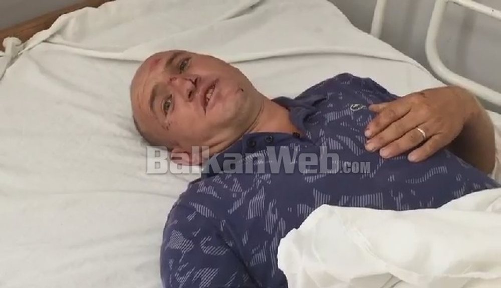 Aksidenti n&euml; Librazhd,  i mbijetuari tregon momentet e tmerrit, akoma nuk e