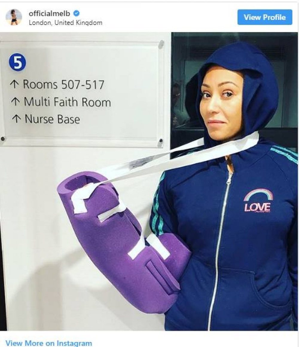 Mel B, aksidenti q&euml; e &ccedil;oi n&euml; gjendje t&euml; r&euml;nd&euml;
