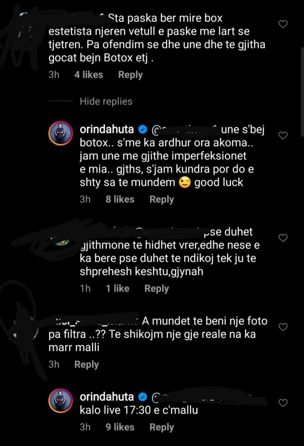 Orinda Huta replika me ndjek&euml;sit n&euml; Instagram p&euml;r operacionet