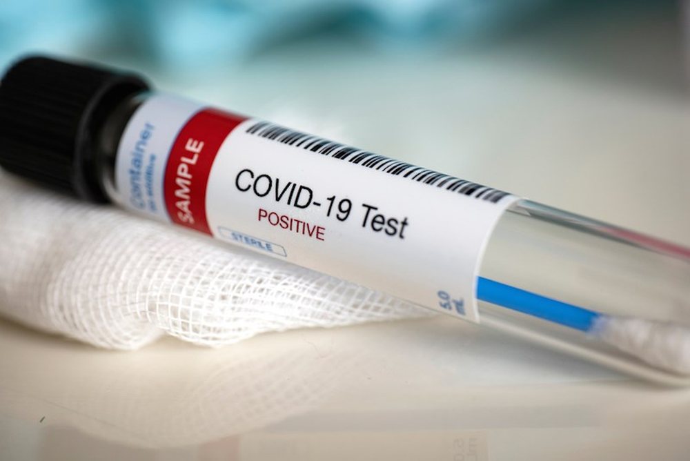 Covid n&euml; Maqedonin&euml; e Veriut, sh&euml;rohen 125 pacient&euml;