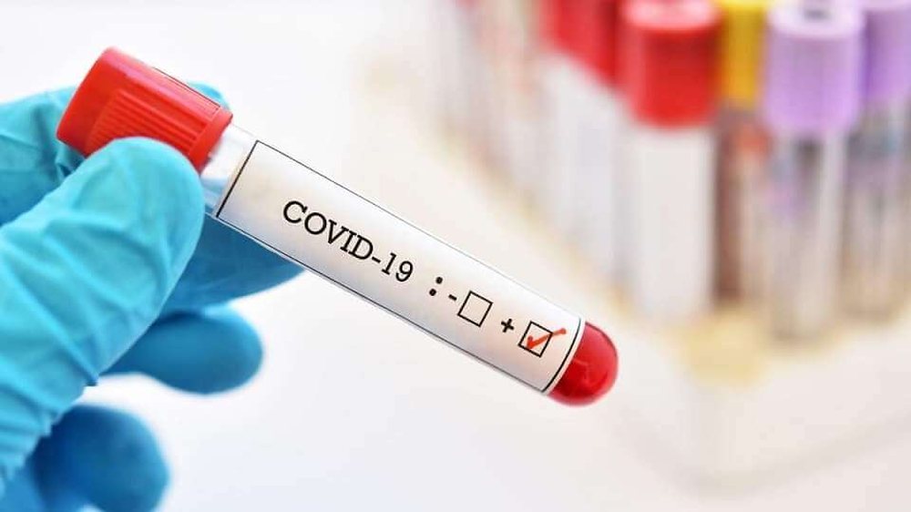 COVID-19 n&euml; Berat/ Infektohet nj&euml; m&euml;sues, punonj&euml;sja e