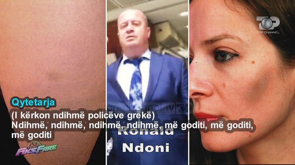 Skandal te Konsullata Shqiptare n&euml; Selanik, punonj&euml;si rreh