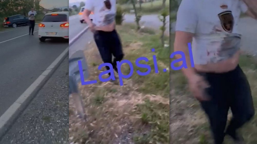 VIDEO/ Identifikohen 2 personat e plagosur n&euml; qend&euml;r t&euml;