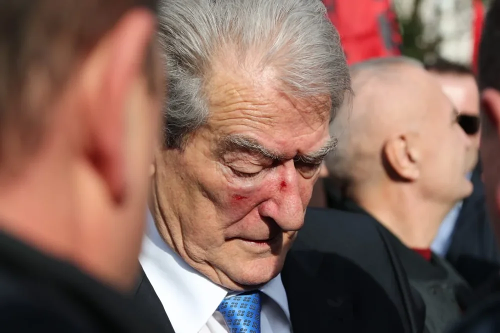 &ldquo;Berisha kishte gjak n&euml; fytyr&euml;&rdquo;, Reuters raporton