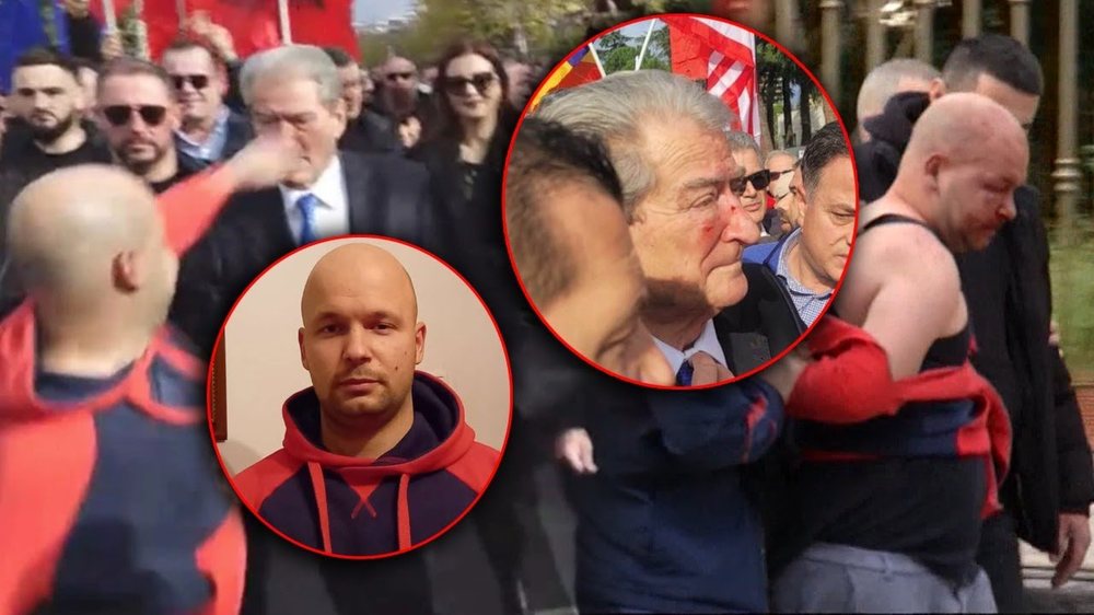 Gert Shehu tentoi t&euml; sulmonte Berish&euml;n q&euml; n&euml; oborrin e