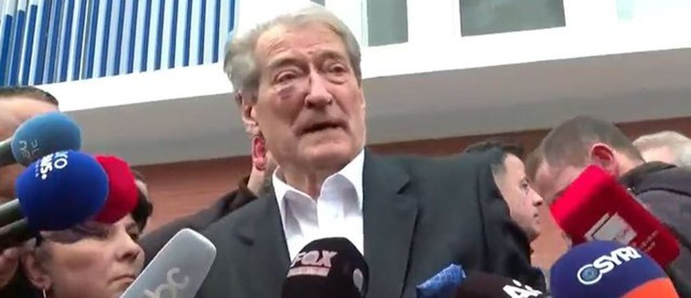 31-vje&ccedil;ari grushtoi ndaj tij/ Berisha akuza qeveris&euml;: Kaluan n&euml;