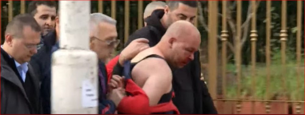 Goditi me grusht Berish&euml;n, shoq&euml;rohet nga policia autori i gjakosur