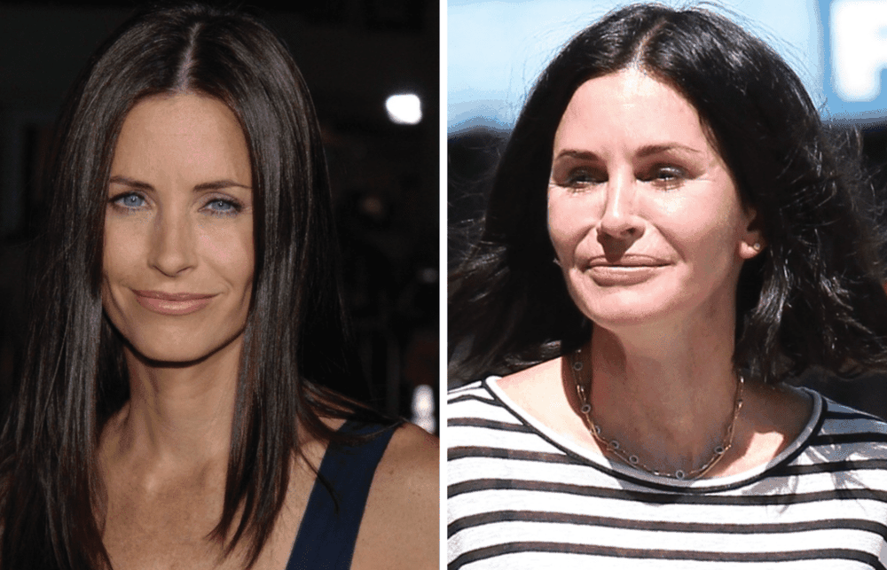Courteney Cox: Jam penduar p&euml;r nd&euml;rhyrjet estetike