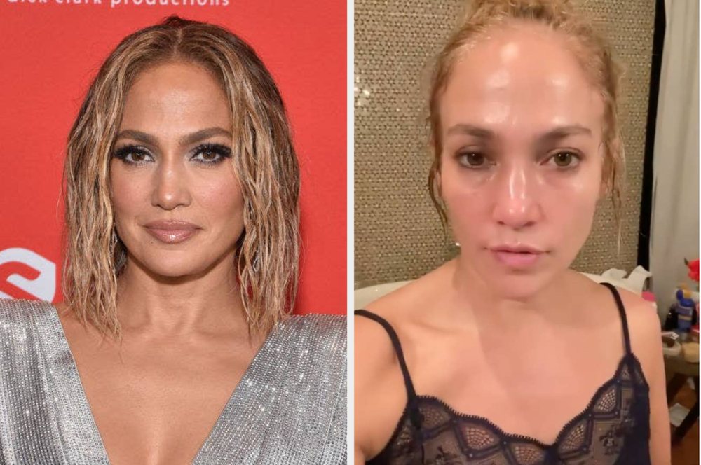 Jennifer Lopez reagon ndaj akuzave: Nuk kam b&euml;r&euml; botox