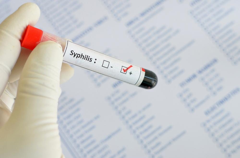 Seks&igrave; oral po shp&euml;rthen sifilizin n&euml; Shqip&euml;ri