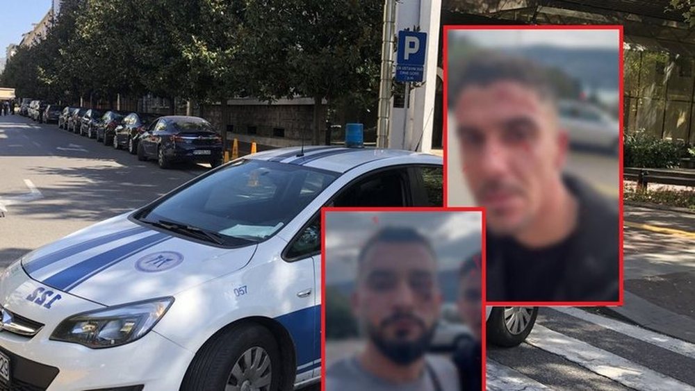 Dhuna ndaj 3 shqiptar&euml;ve n&euml; Malin e Zi, arrestohen 5 autor&euml;