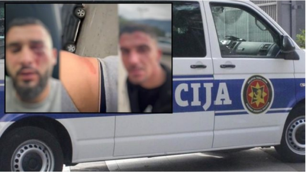 Dhuna ndaj tre shqiptar&euml;ve n&euml; Mal t&euml; Zi, kreu i Unionit