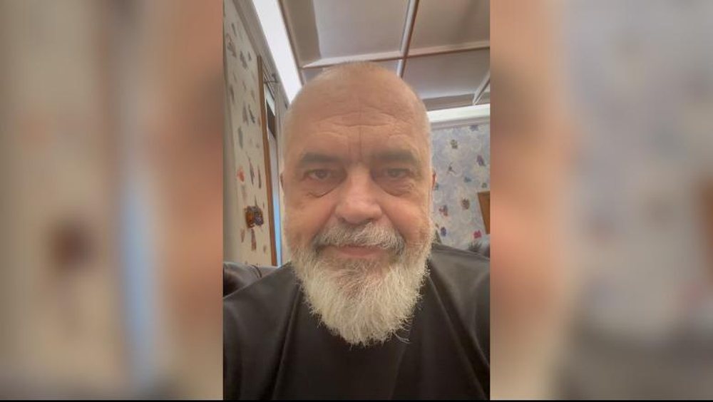 Rama e thot&euml; me seriozitet: Shumica e njer&euml;zve t&euml; k&euml;naqur