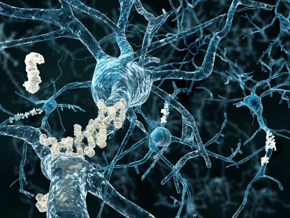 Studimi/ Terapia p&euml;r kancerin jep rezultate n&euml; luftimin e Alzheimer