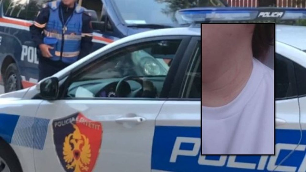 Dhunohet nj&euml; grua n&euml; Vlor&euml;, akuzon fqinjin e prind&euml;rve