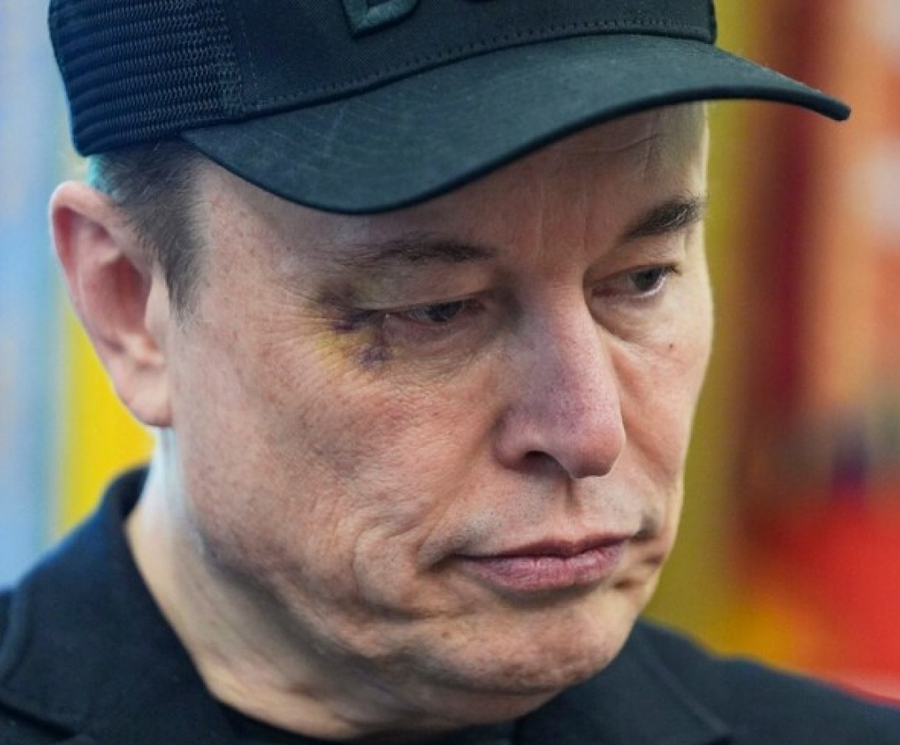 Elon Musk pas dorëheqjes shfaqet me syrin e nxirë në