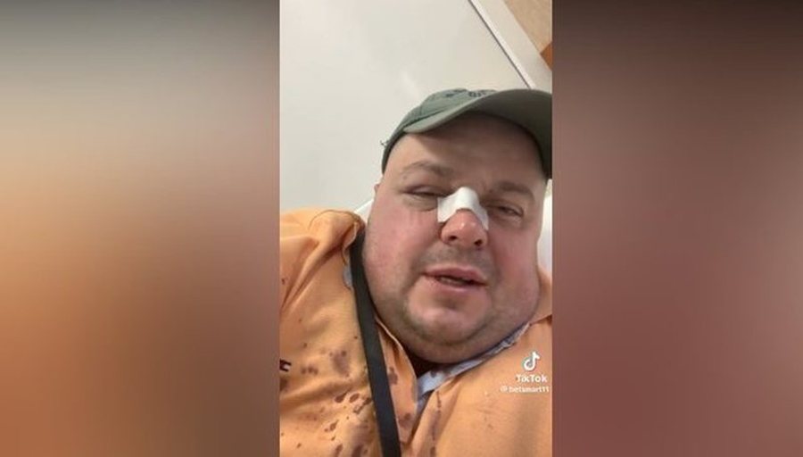 Zbulohet arsyeja pse u dhunua, Genard Hajdini dhe babai i tij