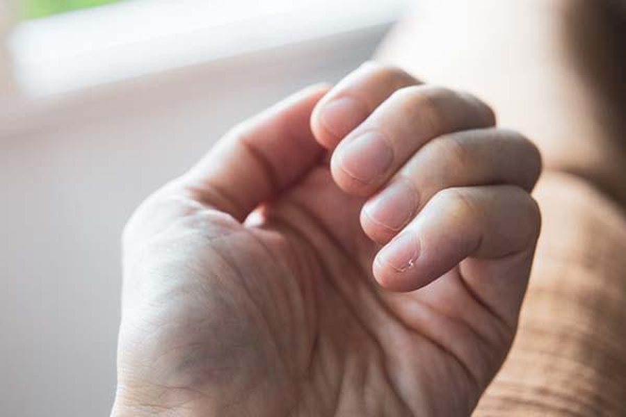 Pesë SHENJAT që ju japin duart kur keni problem me tiroiden
