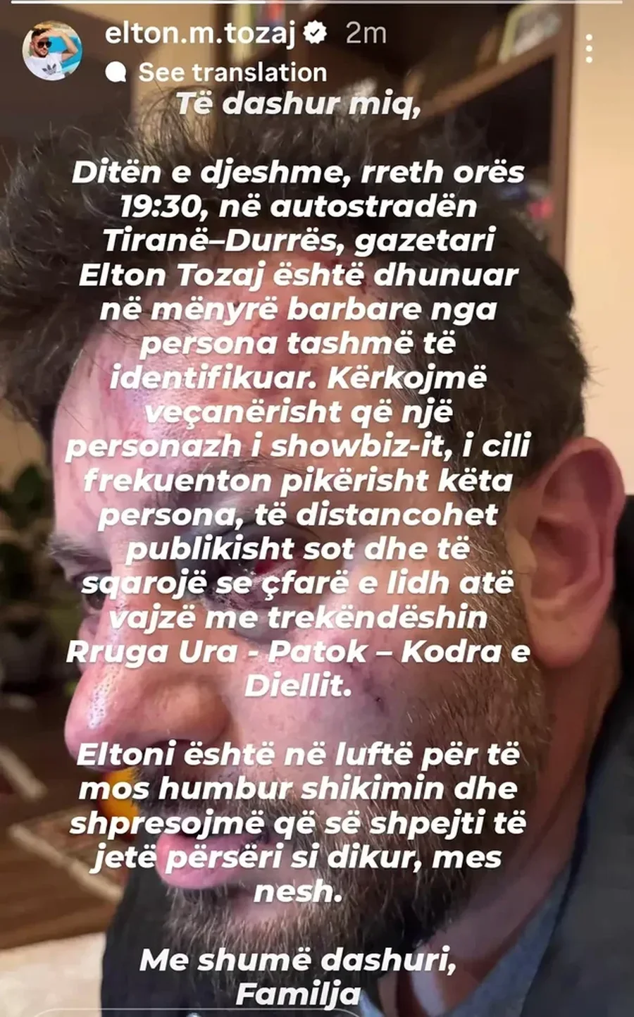 Publikohen PAMJET/ Rrahja brutale e gazetarit, DYSHIMET e para: Cila