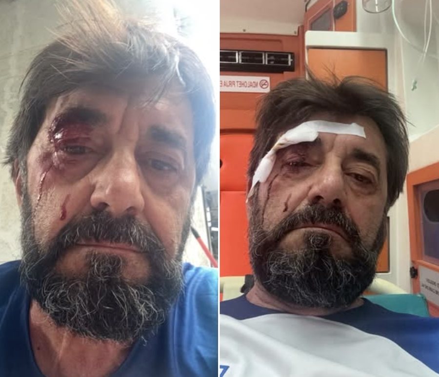 Gjakoset n&euml; mes t&euml; Tiran&euml;s analisti Ilir Demalia (PAMJE T&Euml;