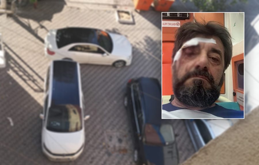 Policia identifikon personin q&euml; gjakosi gazetarin, Ilir Demalia u godit