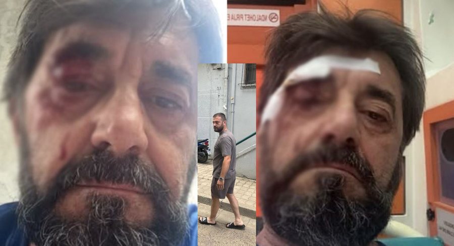 KUSH e dhunoi Ilir Demaliajn? Del FOTO dhe EMRI i personit q&euml; u vu n&euml;