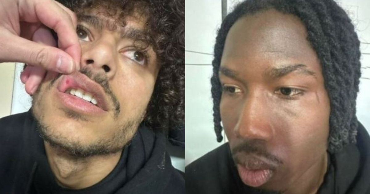 Dhuna në Iliria   Skënderbeu  policia nis hetimet për 2 futbollistë dhe 1 zyrtar të klubit nga Fushë   Kruja