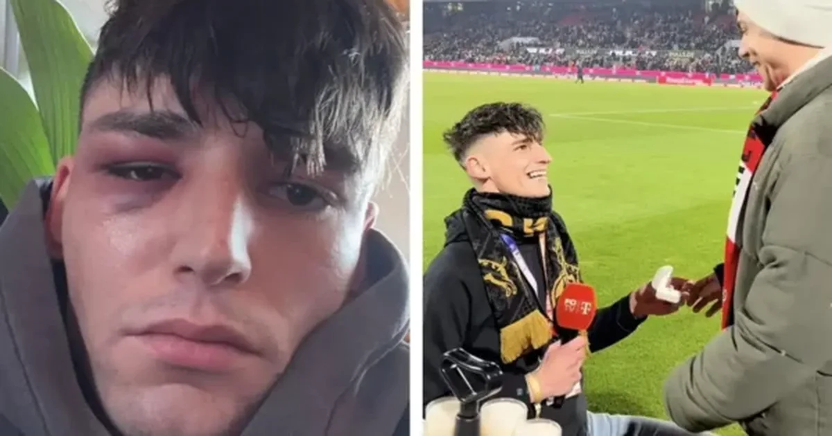 VIDEO  I propozoi për martesë partnerit gjatë ndeshjes Köln   Wolfsburg  arbitri gjerman dhunohet në shtëpinë e tij