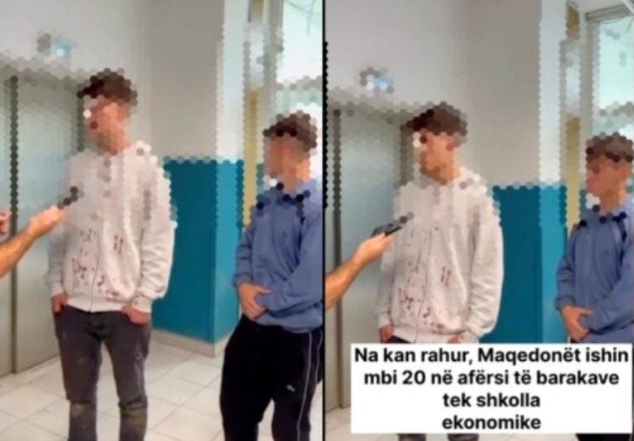 Dy nxënësit shqiptarë rrihen barbarisht nga huliganët e