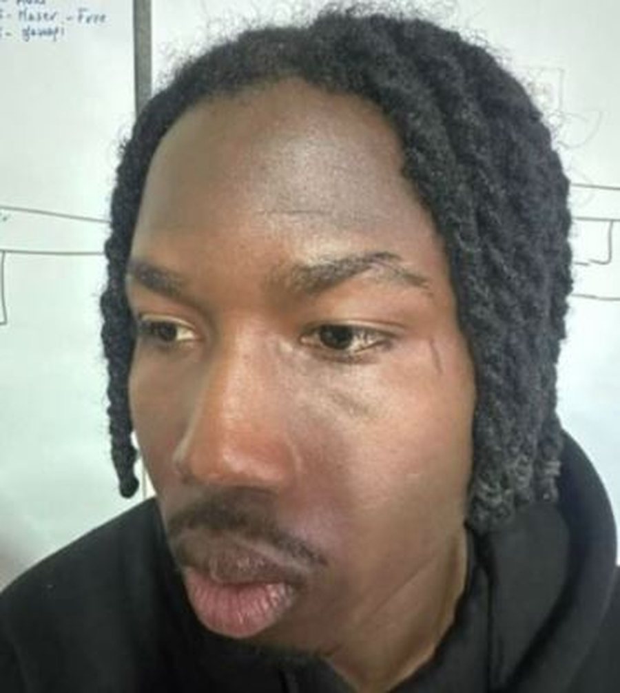 Në Fushë-Krujë nuk flitet më për futboll, dalin FOTOT: