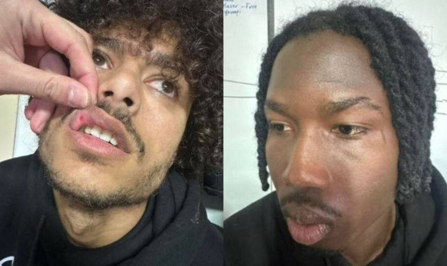 Iliria REAGON sërish ndaj FOTOVE të publikuara nga lojtarët e