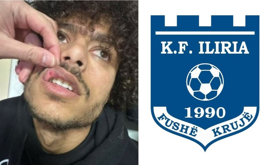 Iliria REAGON sërish ndaj FOTOVE të publikuara nga lojtarët e