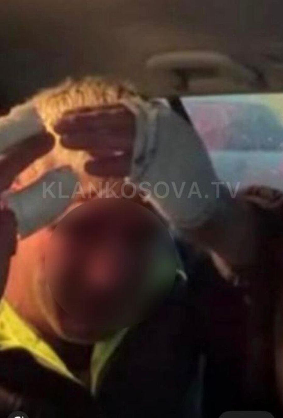 FOTO/ Babë e bir sulmojnë tifozin e Ballkanit, ndërhyrja e klubit