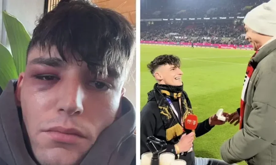 VIDEO/ I propozoi p&euml;r martes&euml; partnerit gjat&euml; ndeshjes K&ouml;ln